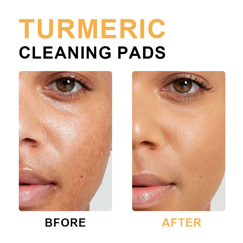 No 1ogo Turmeric Kojic Acid Cleaning Tablets Yellow Bag